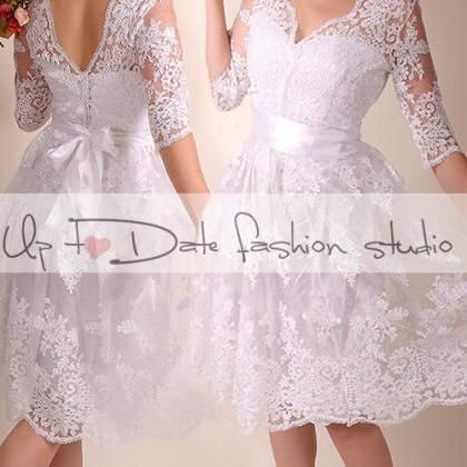 Lace Wedding Dress/v Front And Back/recepion/knee..